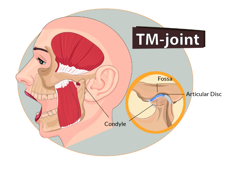 Why TMJ Noise Is Important Cosmetic Dentistry | Henry